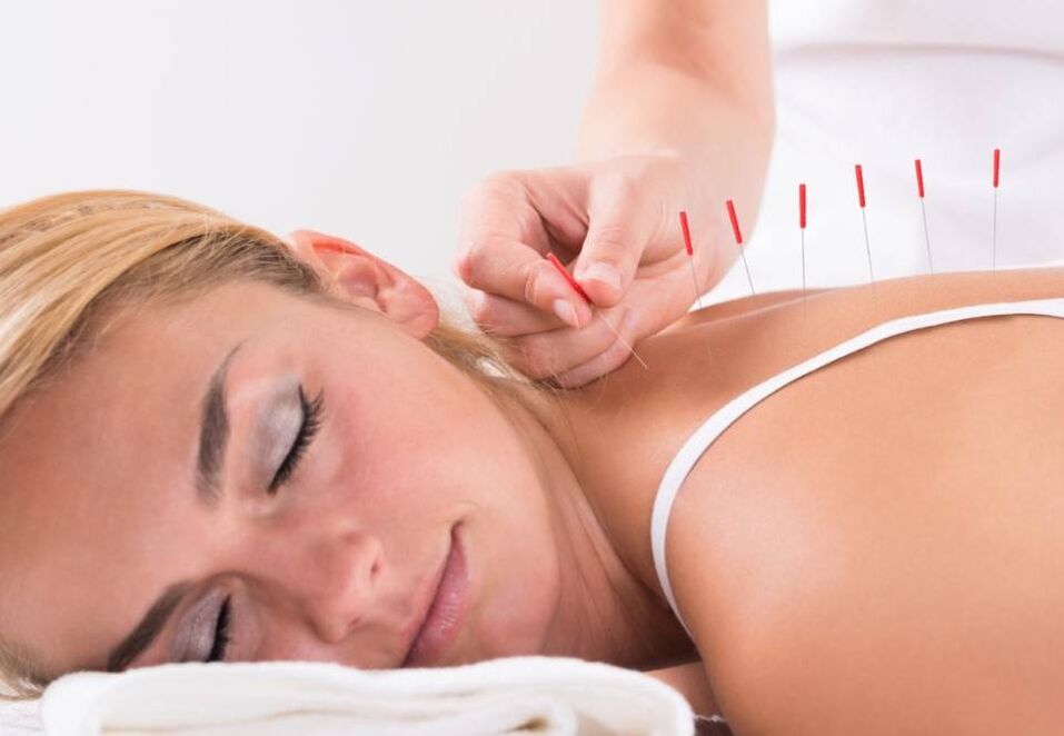 Akupunktur hilft, Schmerzen bei Osteochondrose zu lindern